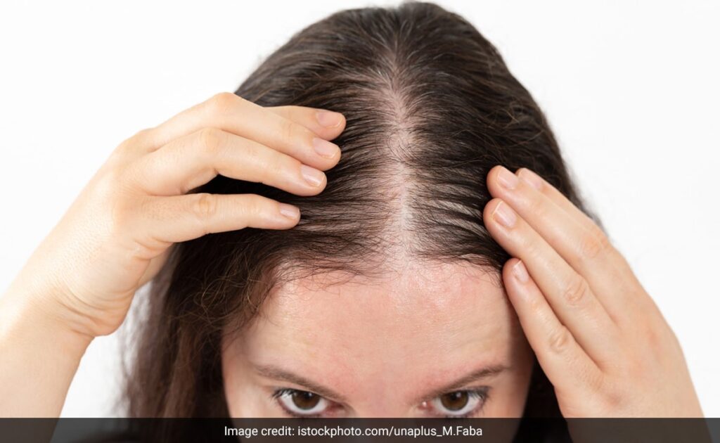अंडे से लेकर मेथी के दानों तक, यहां जानिए बालों का झड़ना रोकने में किन चीजों का दिखता है रामबाण असर