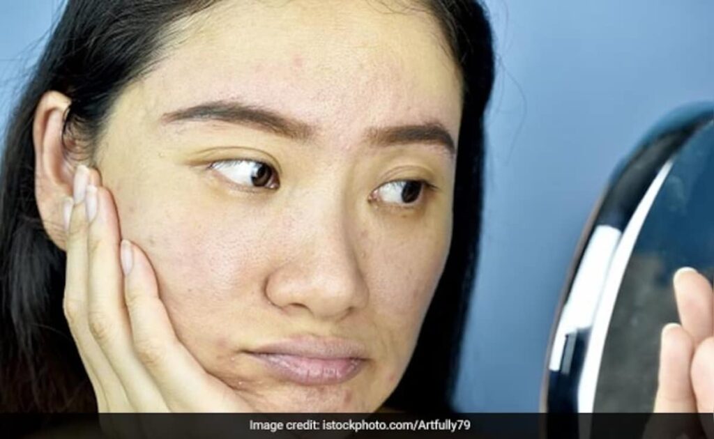 Dry Skin Care In Winters: सर्दियों में रूखी सूखी स्किन कर रही है बार बार परेशान, इन तरीकों से चुटकियों में मिलेगा निखार