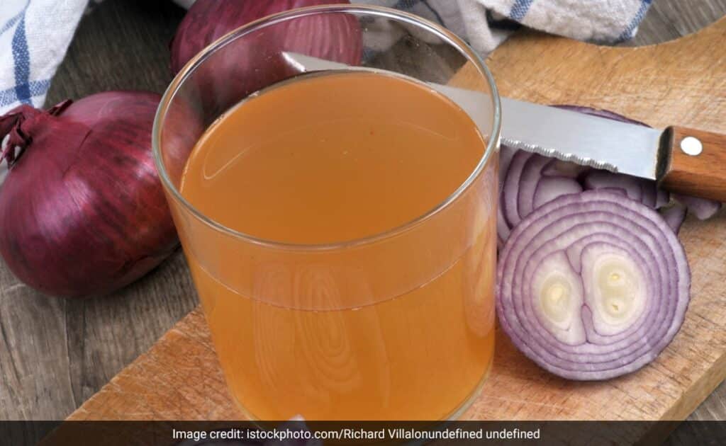 प्याज से बनाकर लगा लिए ये 4 हेयर मास्क तो तेजी से बढ़ने लगेंगे बाल, लंबाई देखकर रह जाएंगे दंग