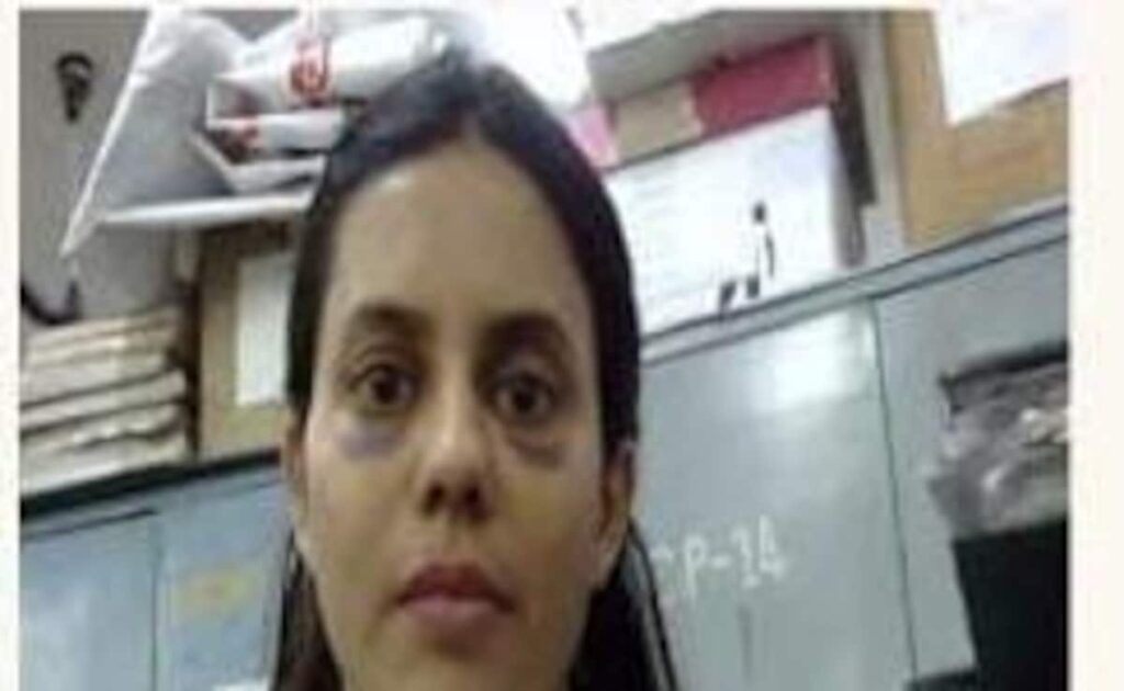 क्या रन्या राव पर हिरासत में पीटा गया? वायरल फोटो पर महिला आयोग ने जानिए क्या कहा